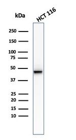 Cytokeratin 8 (KRT8) Antibody in Western Blot (WB)