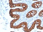 Cytokeratin 8 (KRT8) Antibody in Immunohistochemistry (Paraffin) (IHC (P))