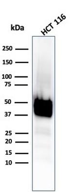 Cytokeratin 8 (KRT8) Antibody in Western Blot (WB)