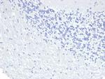 Cytokeratin 8 (KRT8) Antibody in Immunohistochemistry (Paraffin) (IHC (P))