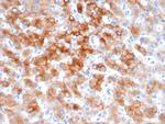 Cytokeratin 8 (KRT8) Antibody in Immunohistochemistry (Paraffin) (IHC (P))