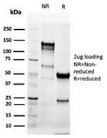 Cytokeratin 8 (KRT8) Antibody in SDS-PAGE (SDS-PAGE)