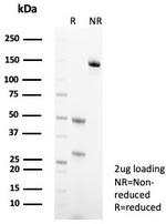 Cytokeratin 10 (Suprabasal Epithelial Marker) Antibody in SDS-PAGE (SDS-PAGE)