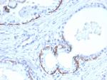 Cytokeratin 10 (Suprabasal Epithelial Marker) Antibody in Immunohistochemistry (Paraffin) (IHC (P))