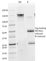 Cytokeratin 10 (Suprabasal Epithelial Marker) Antibody in SDS-PAGE (SDS-PAGE)