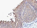 Cytokeratin 10 (Suprabasal Epithelial Marker) Antibody in Immunohistochemistry (Paraffin) (IHC (P))