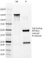 Cytokeratin 10 (Suprabasal Epithelial Marker) Antibody in SDS-PAGE (SDS-PAGE)