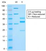 Cytokeratin 10 (KRT10) (Suprabasal Epithelial Marker) Antibody in SDS-PAGE (SDS-PAGE)