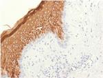 Cytokeratin 10 Antibody in Immunohistochemistry (Paraffin) (IHC (P))