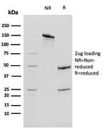 Cytokeratin 13 (Non-Keratinized Squamous Epithelial Marker) Antibody in SDS-PAGE (SDS-PAGE)