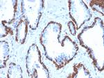 Cytokeratin 13 (Non-Keratinized Squamous Epithelial Marker) Antibody in Immunohistochemistry (Paraffin) (IHC (P))