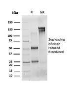 Cytokeratin 13 Antibody in SDS-PAGE (SDS-PAGE)