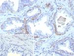 Cytokeratin 13 (Non-Keratinized Squamous Epithelial Marker) Antibody in Immunohistochemistry (Paraffin) (IHC (P))