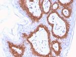 Cytokeratin 14 (KRT14) (Squamous Cell Marker) Antibody in Immunohistochemistry (Paraffin) (IHC (P))