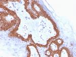 Cytokeratin 14 (KRT14) (Squamous Cell Marker) Antibody in Immunohistochemistry (Paraffin) (IHC (P))