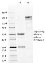 Cytokeratin 14 (KRT14) (Squamous Cell Marker) Antibody in SDS-PAGE (SDS-PAGE)