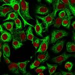 Cytokeratin 14 (KRT14) (Squamous Cell Marker) Antibody in Immunocytochemistry (ICC/IF)