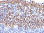 Cytokeratin 14 (KRT14) (Squamous Cell Marker) Antibody in Immunohistochemistry (Paraffin) (IHC (P))