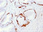 Cytokeratin 14 (KRT14) (Squamous Cell Marker) Antibody in Immunohistochemistry (Paraffin) (IHC (P))