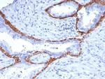 Cytokeratin 14 (KRT14) (Squamous Cell Marker) Antibody in Immunohistochemistry (Paraffin) (IHC (P))