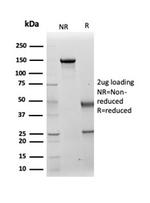 Cytokeratin 14 (KRT14) (Squamous Cell Marker) Antibody in SDS-PAGE (SDS-PAGE)