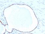 Cytokeratin 14 (KRT14) (Squamous Cell Marker) Antibody in Immunohistochemistry (Paraffin) (IHC (P))