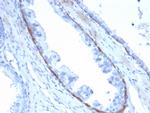 Cytokeratin 14 (KRT14) (Squamous Cell Marker) Antibody in Immunohistochemistry (Paraffin) (IHC (P))