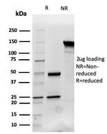 Cytokeratin 14 (KRT14) (Squamous Cell Marker) Antibody in SDS-PAGE (SDS-PAGE)