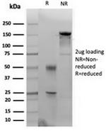 Cytokeratin 14 (KRT14) (Squamous Cell Marker) Antibody in SDS-PAGE (SDS-PAGE)