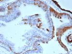 Cytokeratin 14 (KRT14) (Squamous Cell Marker) Antibody in Immunohistochemistry (Paraffin) (IHC (P))