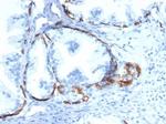 Cytokeratin 14 (KRT14) (Squamous Cell Marker) Antibody in Immunohistochemistry (Paraffin) (IHC (P))