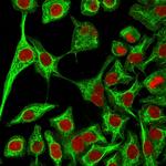 Cytokeratin 14 (Squamous Cell Marker) Antibody in Immunocytochemistry (ICC/IF)