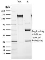 Cytokeratin 14 (Squamous Cell Marker) Antibody in SDS-PAGE (SDS-PAGE)