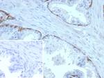 Cytokeratin 14 (KRT14) (Squamous Cell Marker) Antibody in Immunohistochemistry (Paraffin) (IHC (P))