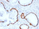 Cytokeratin 14 (KRT14) (Squamous Cell Marker) Antibody in Immunohistochemistry (Paraffin) (IHC (P))