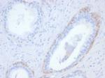 Cytokeratin 14 (KRT14) (Squamous Cell Marker) Antibody in Immunohistochemistry (Paraffin) (IHC (P))