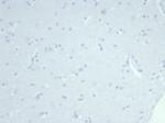 Cytokeratin 14 (KRT14) (Squamous Cell Marker) Antibody in Immunohistochemistry (Paraffin) (IHC (P))