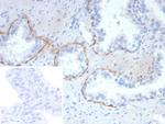 Cytokeratin 14 (KRT14) (Squamous Cell Marker) Antibody in Immunohistochemistry (Paraffin) (IHC (P))