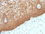 Cytokeratin 14 (KRT14) (Squamous Cell Marker) Antibody in Immunohistochemistry (Paraffin) (IHC (P))