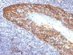 Cytokeratin 14 (KRT14) (Squamous Cell Marker) Antibody in Immunohistochemistry (Paraffin) (IHC (P))