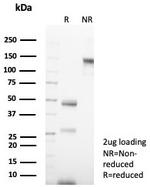 Cytokeratin 14 (KRT14) (Squamous Cell Marker) Antibody in SDS-PAGE (SDS-PAGE)