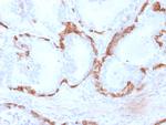 Cytokeratin 14 (KRT14) (Squamous Cell Marker) Antibody in Immunohistochemistry (Paraffin) (IHC (P))