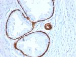 Cytokeratin 14 (KRT14) (Squamous Cell Marker) Antibody in Immunohistochemistry (Paraffin) (IHC (P))