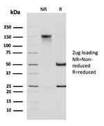 Cytokeratin 14 (KRT14) (Squamous Cell Marker) Antibody in SDS-PAGE (SDS-PAGE)