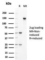 Cytokeratin 14 (KRT14) (Squamous Cell Marker) Antibody in SDS-PAGE (SDS-PAGE)