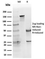 Cytokeratin 14 (KRT14) (Squamous Cell Marker) Antibody in SDS-PAGE (SDS-PAGE)