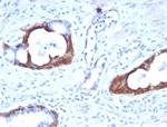 Cytokeratin 14 (KRT14) (Squamous Cell Marker) Antibody in Immunohistochemistry (Paraffin) (IHC (P))