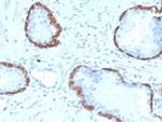 Cytokeratin 14 (KRT14) (Squamous Cell Marker) Antibody in Immunohistochemistry (Paraffin) (IHC (P))