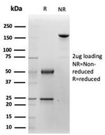 Cytokeratin 14 (KRT14) (Squamous Cell Marker) Antibody in SDS-PAGE (SDS-PAGE)