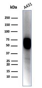 Cytokeratin 14 (KRT14) (Squamous Cell Marker) Antibody in Western Blot (WB)